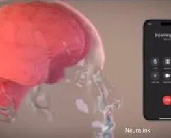 Neuralink
